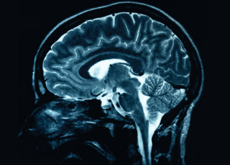 Spacial memories read by brain scanner