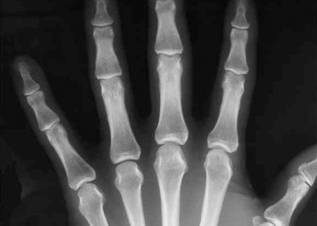 Doctors confirm woman’s imaginary third arm
